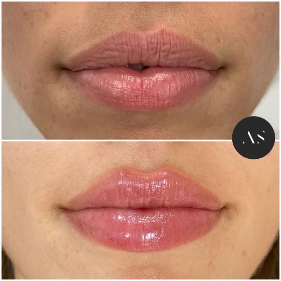 Dr Alejandro Segarra, artist, Facial Beauty By &lsquo;Drawing On Smiles, Madrid is a medical artist